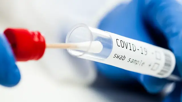 Covid-19 RT-PCR test